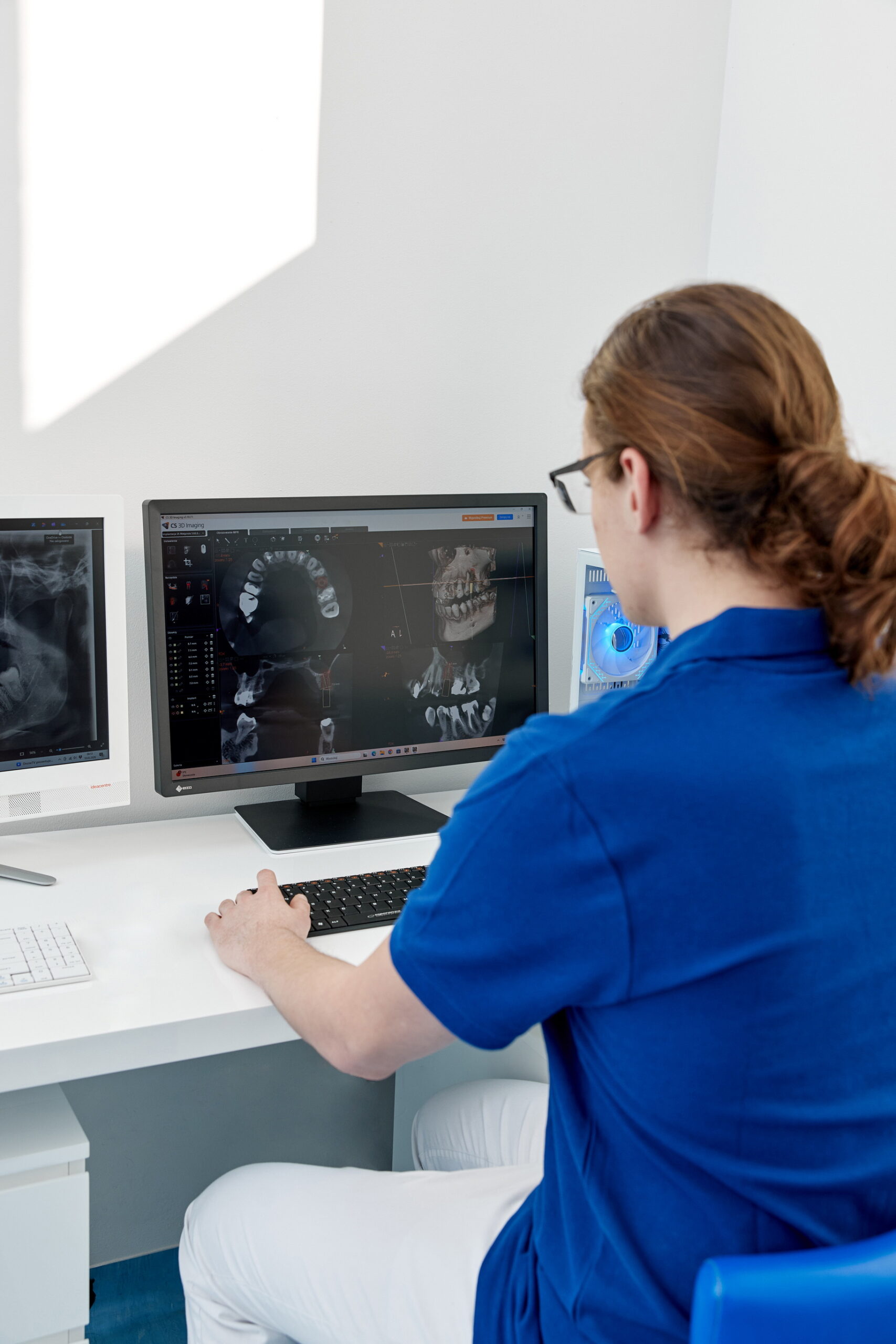 analiza tomografii komputerowej
zębów na ekranie planowanie leczenia stomatologicznego Łódź