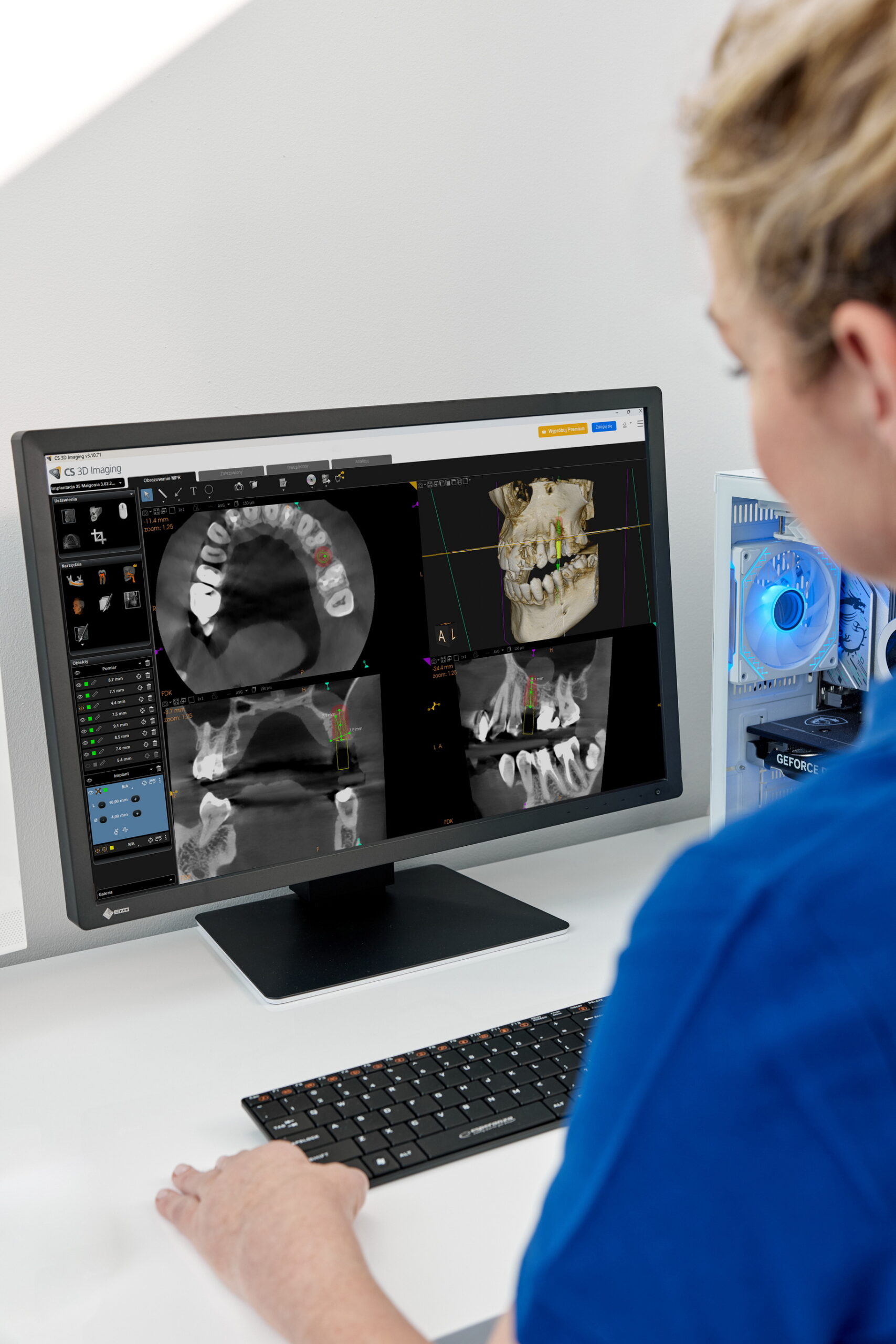 diagnostyka zębów na ekranie komputera planowanie leczenia kanałowego Łódź