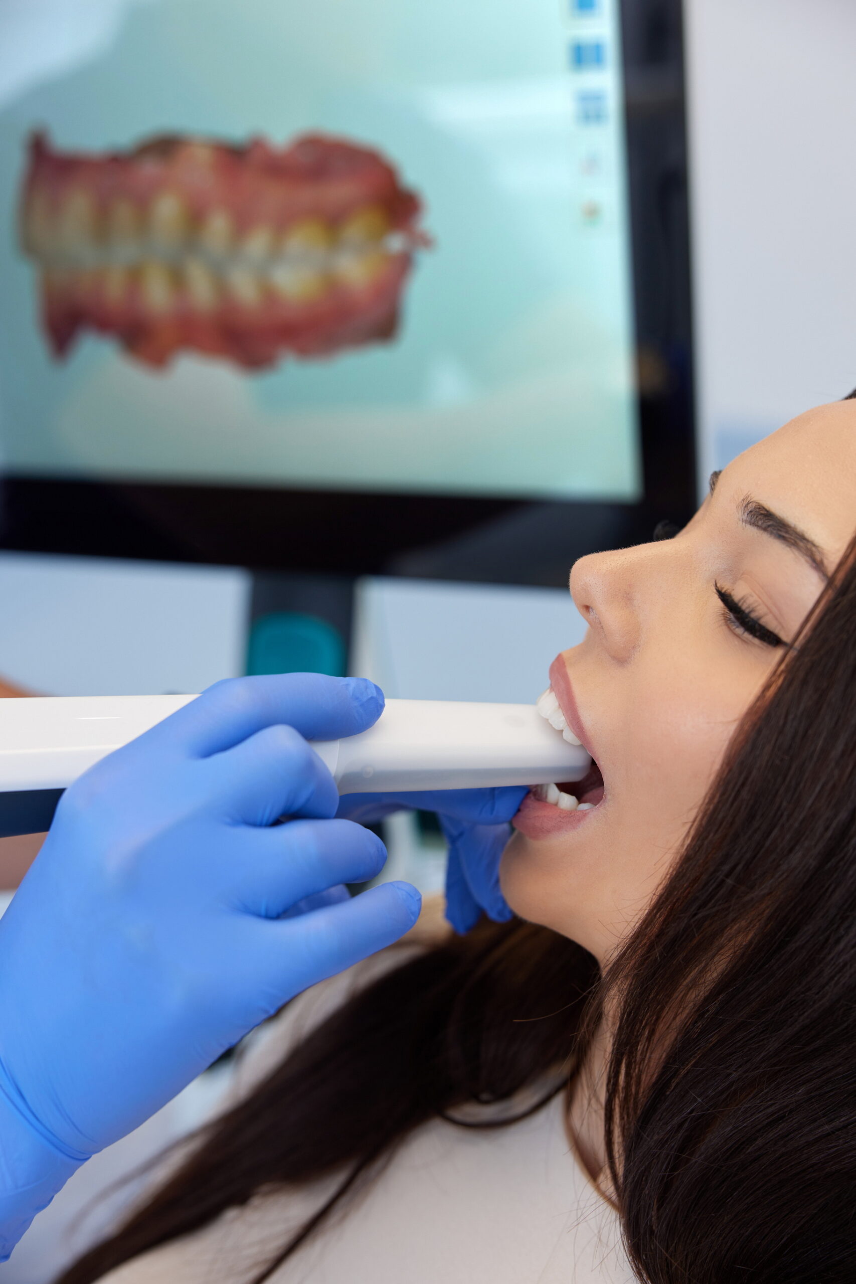 cyfrowe skanowanie zębów diagnostyka 3d stomatolog podczas badania pacjenta