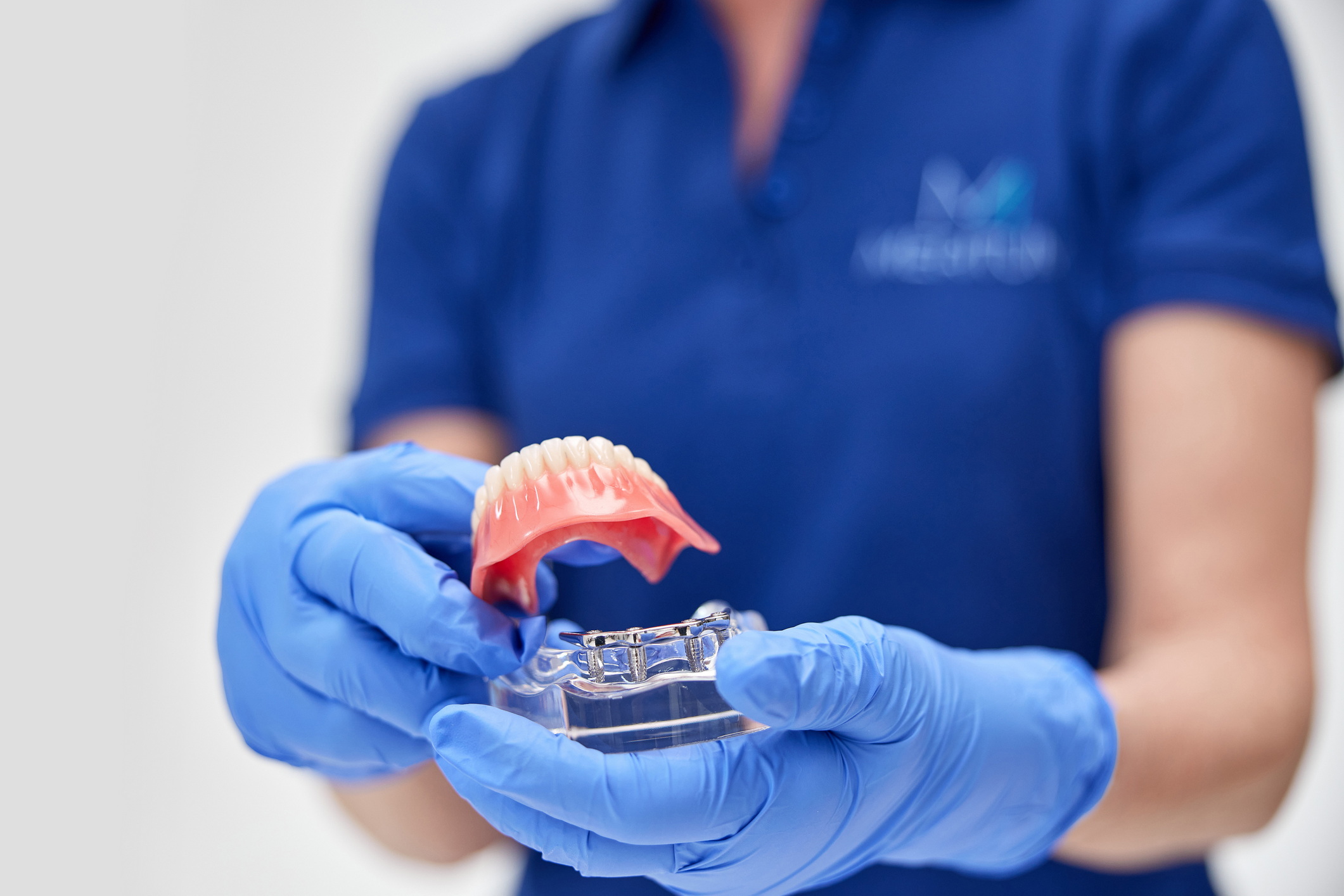 Dentysta pokazuje proteza na implantach