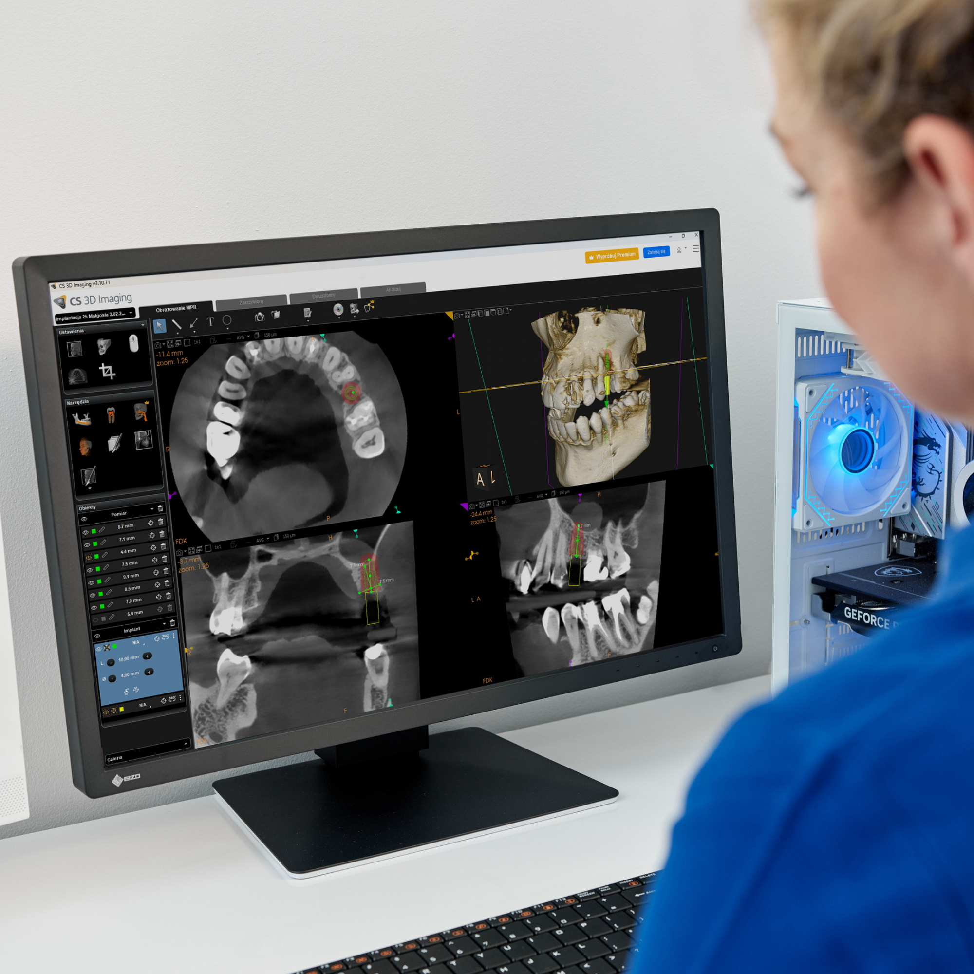 diagnostyka zębów na ekranie komputera planowanie leczenia kanałowego Łódź