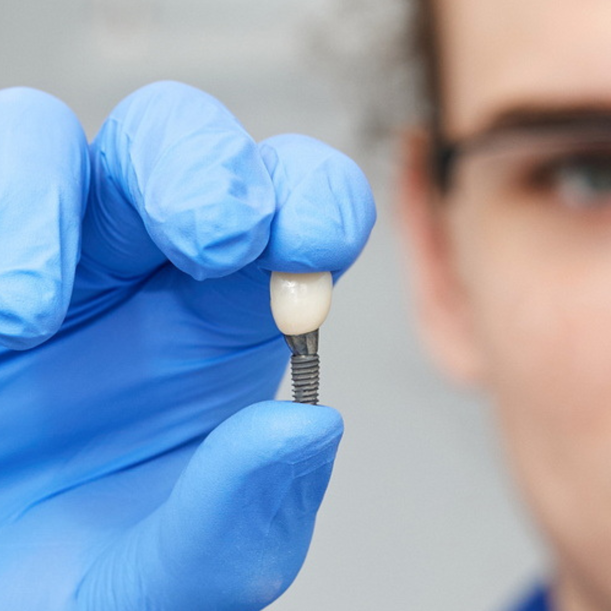 implant stomatologiczny w dłoni lekarza odbudowa po usunięciu zęba Łódź