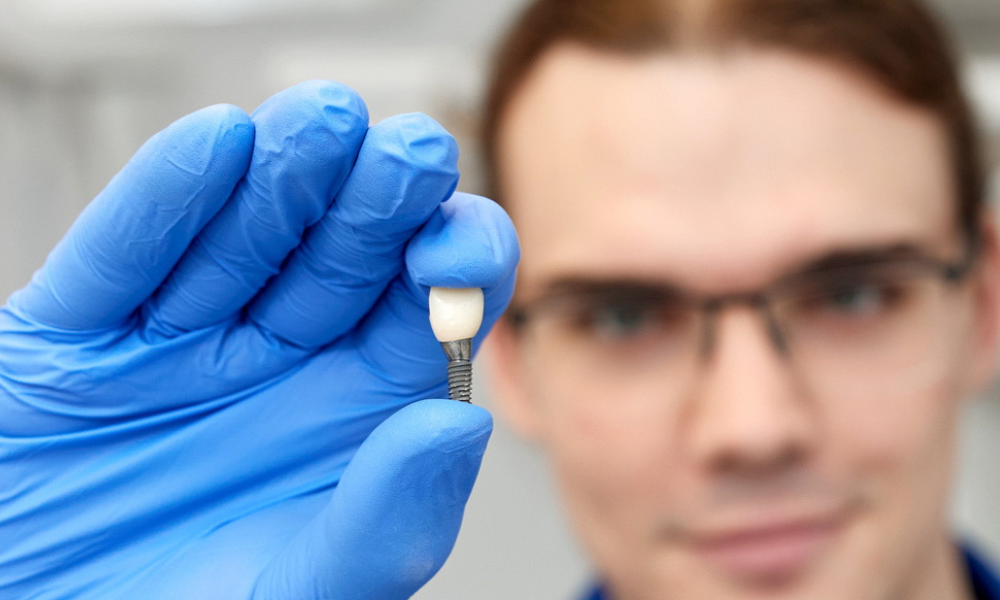 implant zęba w dłoni lekarza przygotowanie do zabiegu implanty zębów Łódź