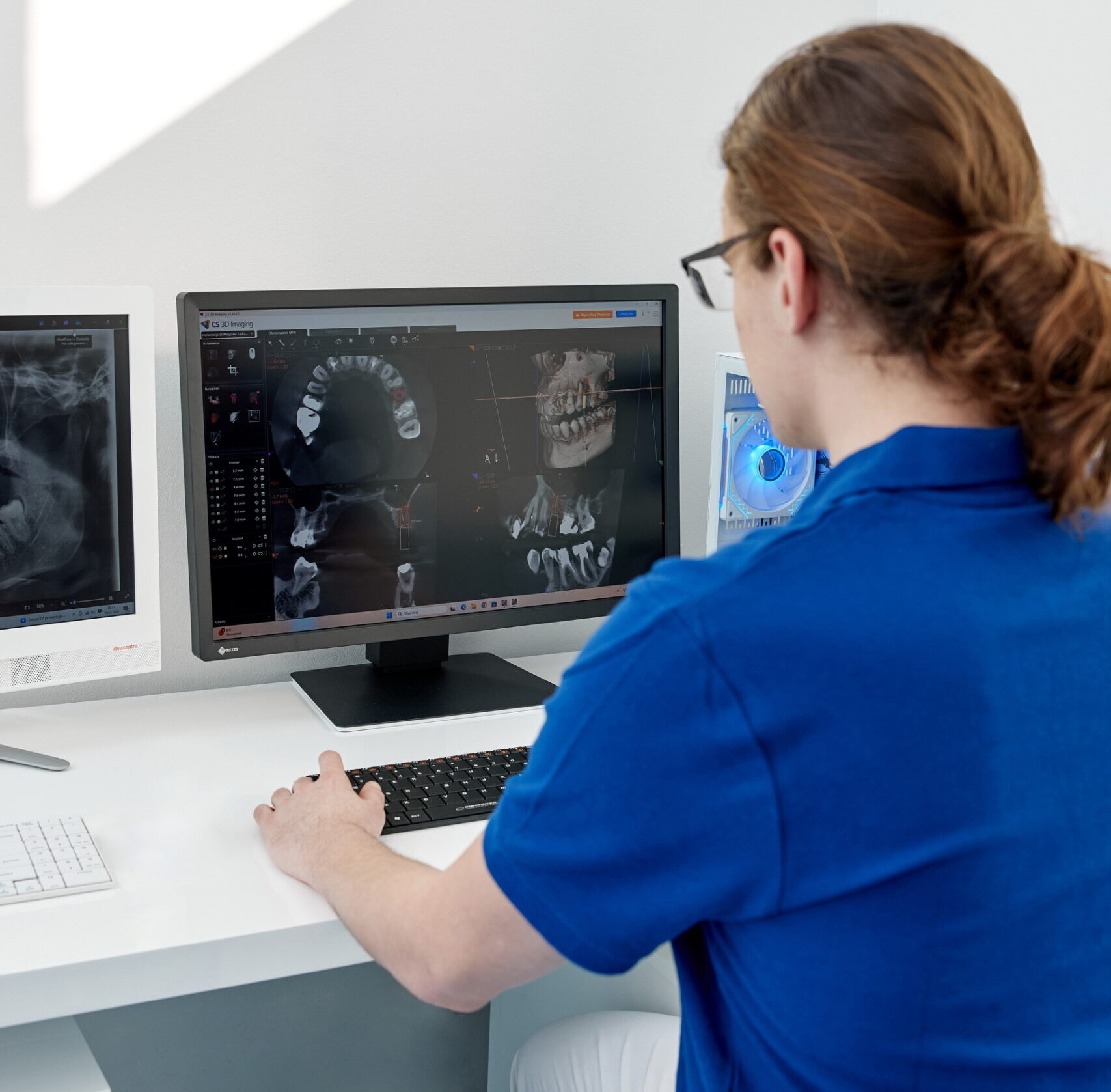 Przygotowanie do implantów – analiza tomografii komputerowej przed leczeniem implantologicznym