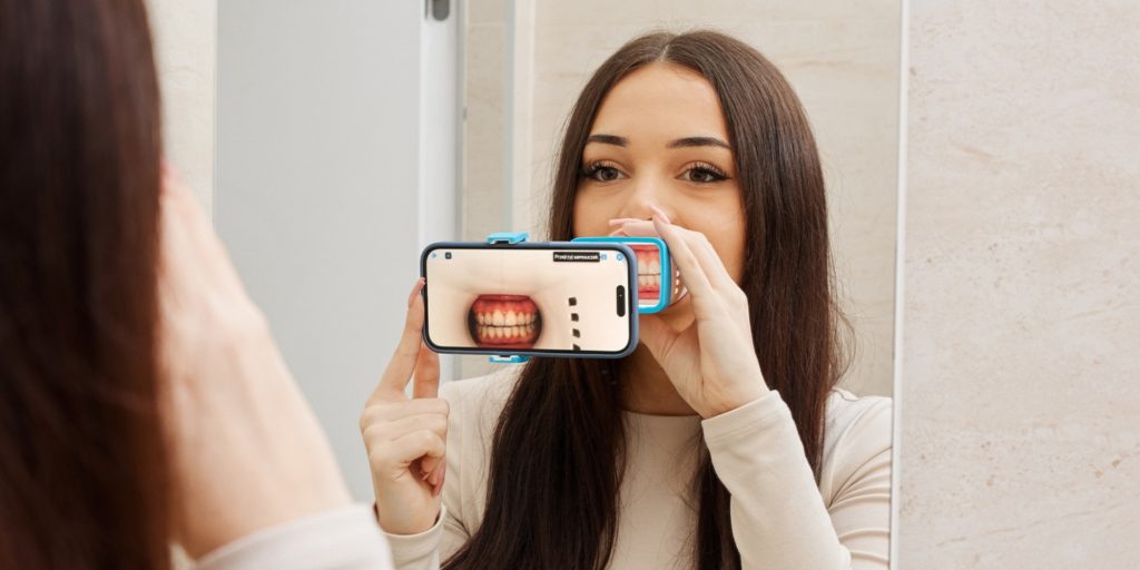 Invisalign Virtual Care – zdalne monitorowanie leczenia ortodontycznego